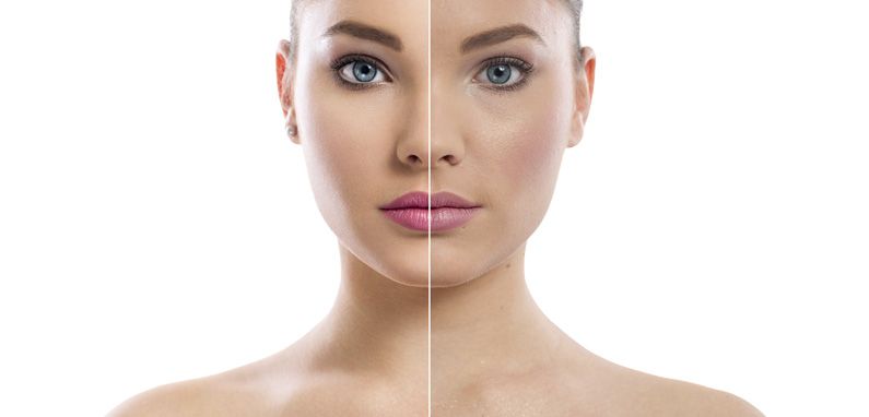 La nueva era del peeling: Bio Revitalización para una piel radiante sin agresión