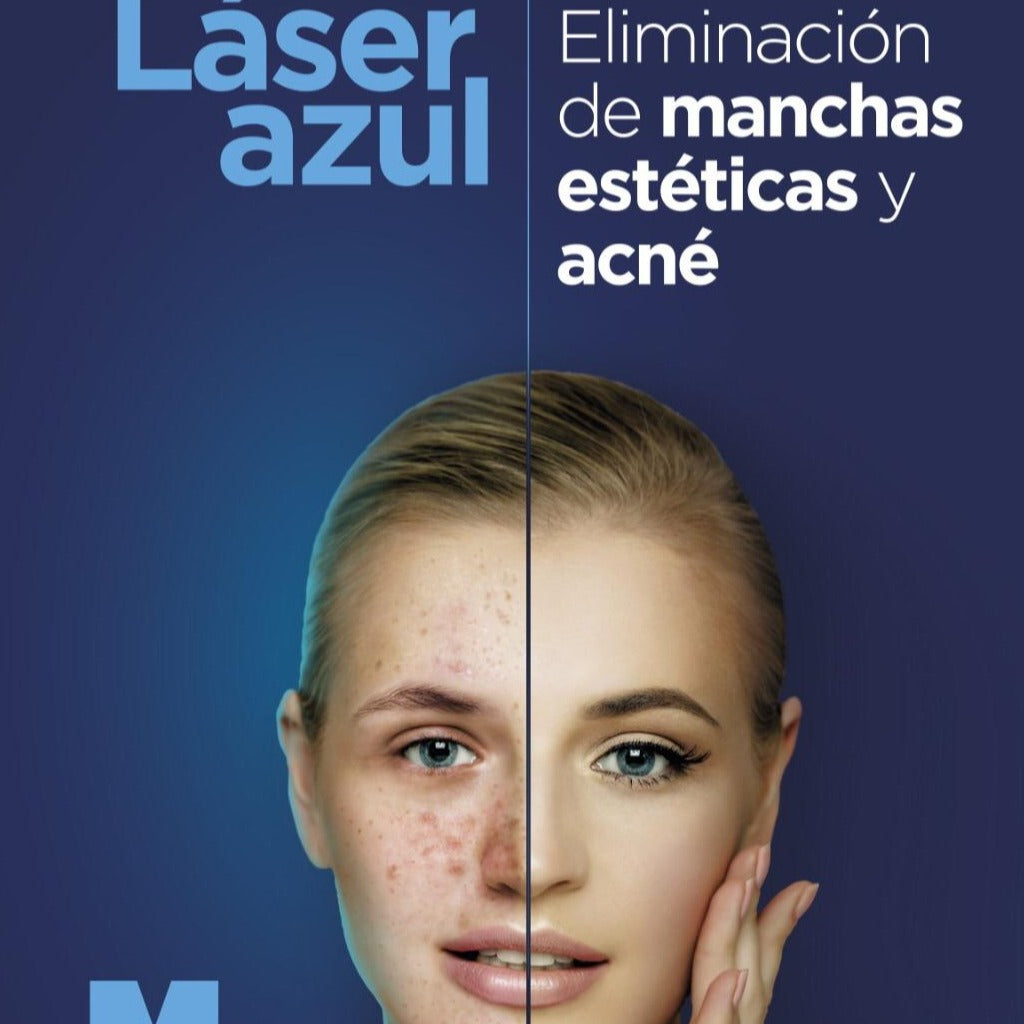 Laser Azul para lesiones benignas y manchas