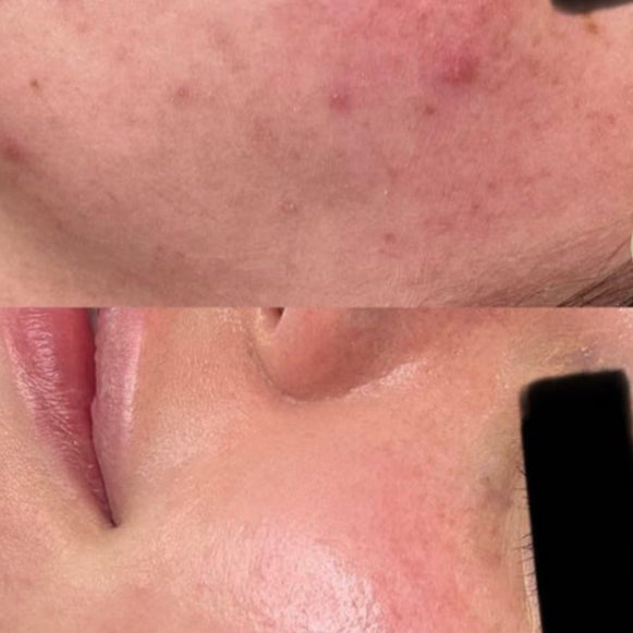 Perfect Tone Glow