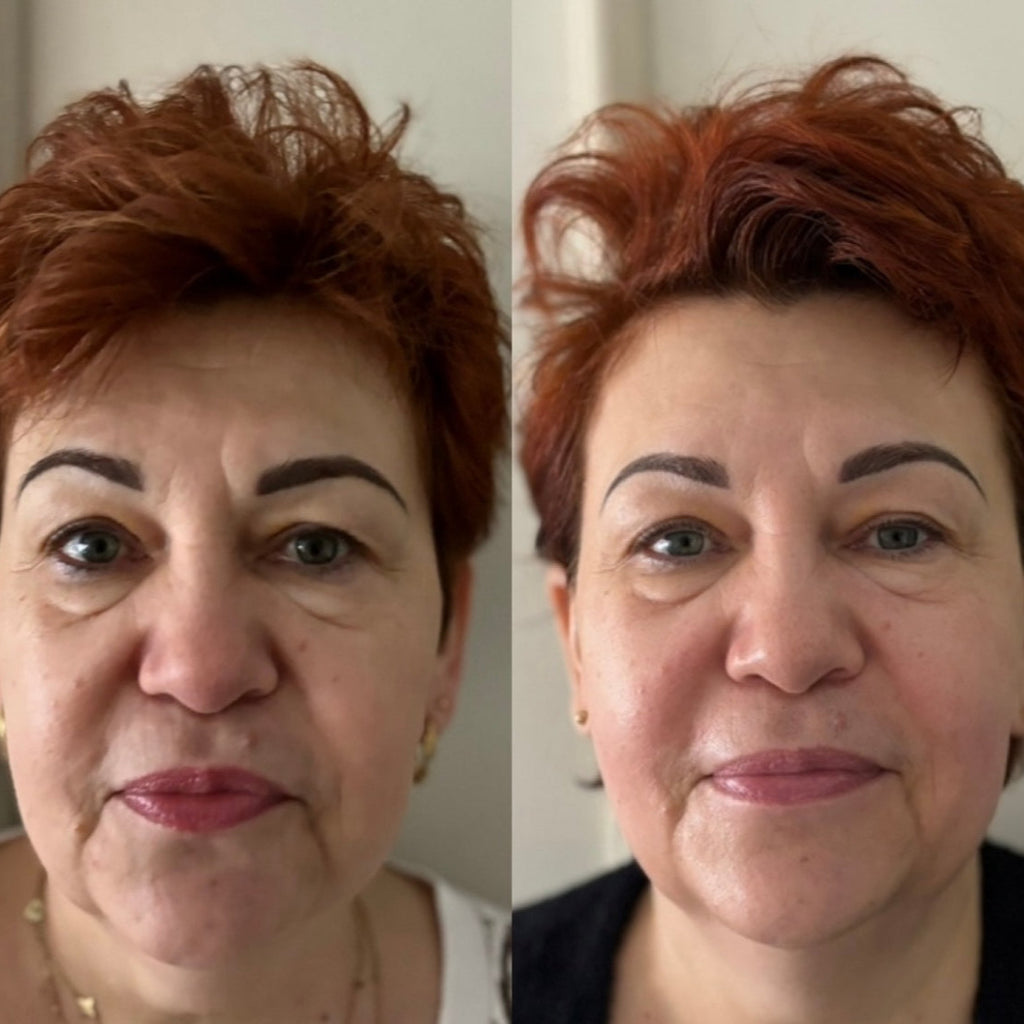 Kobido Terapia Detox