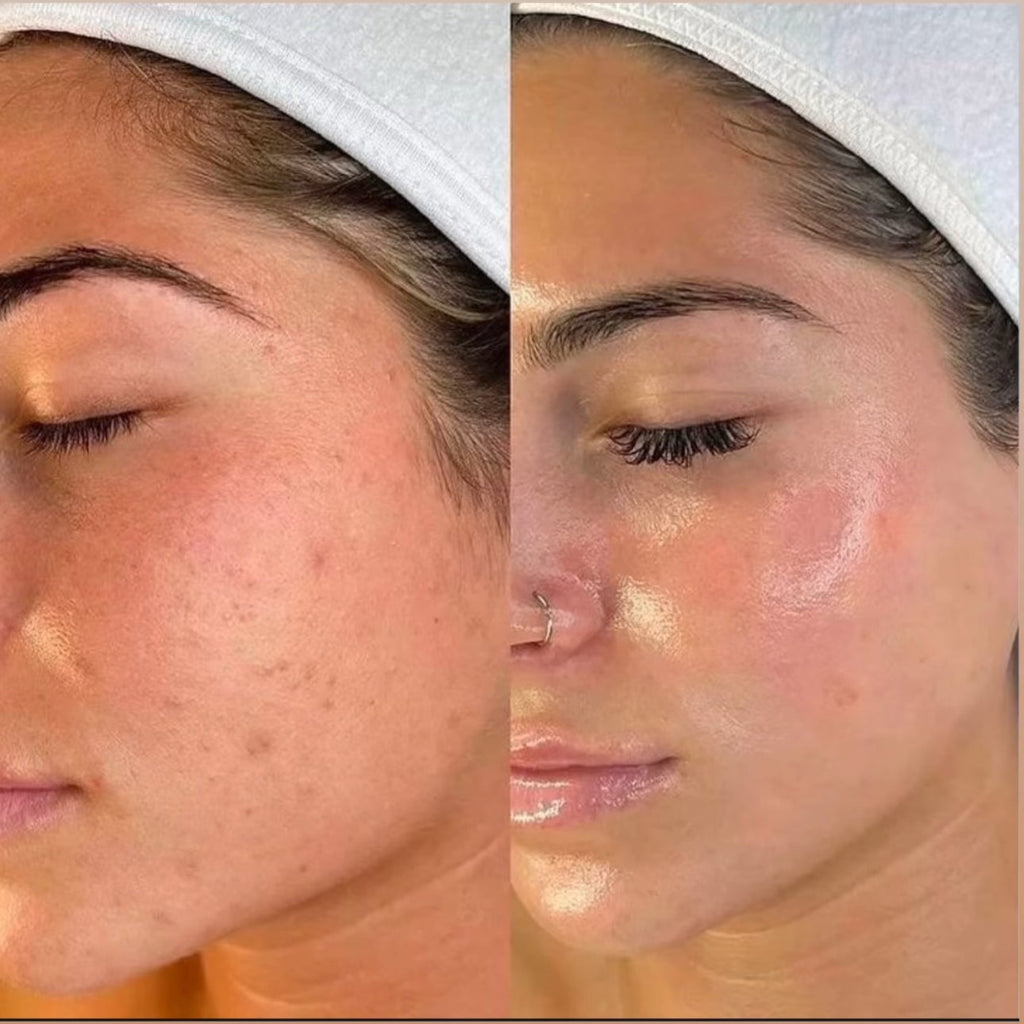 Perfect Tone Glow