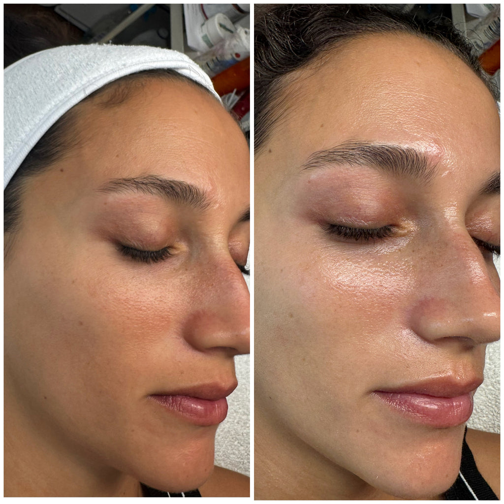 Tratamiento Diamond Hidra Glow