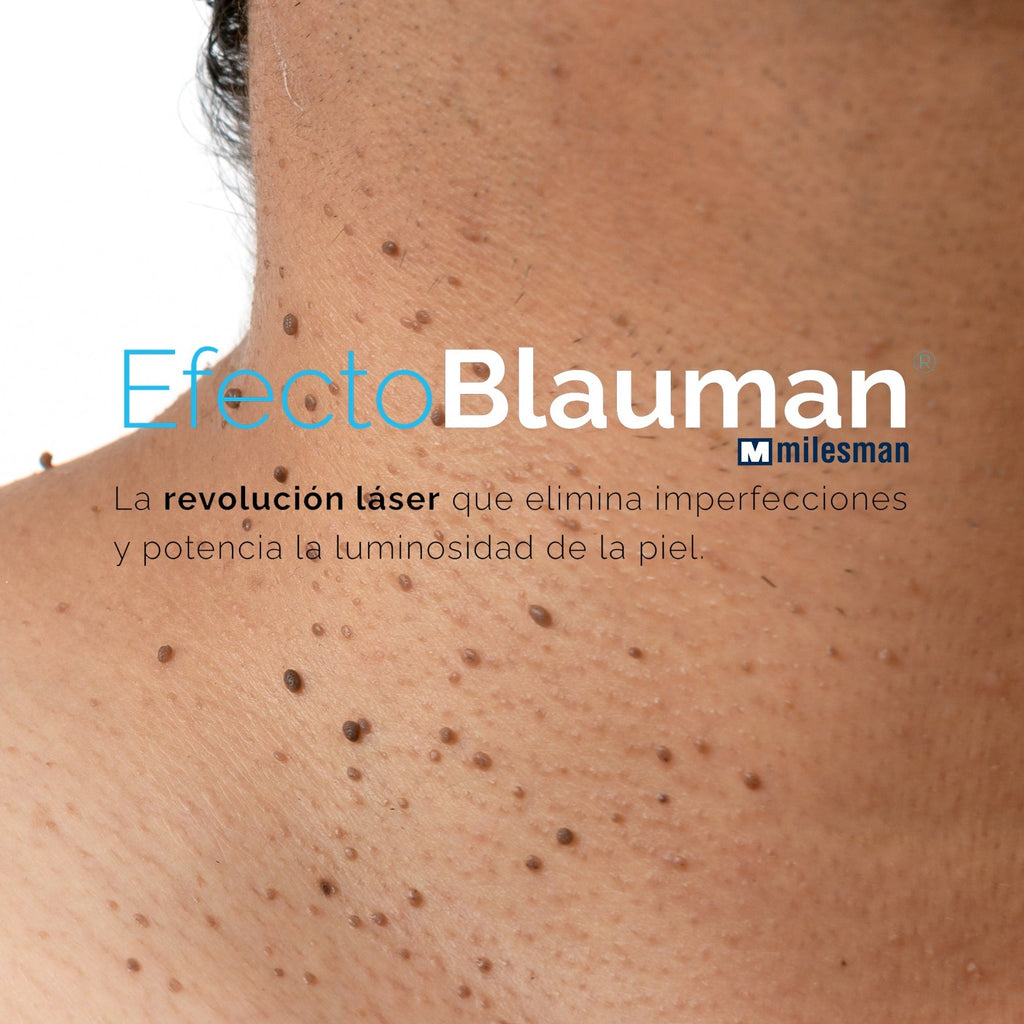 Laser Azul para lesiones benignas y manchas