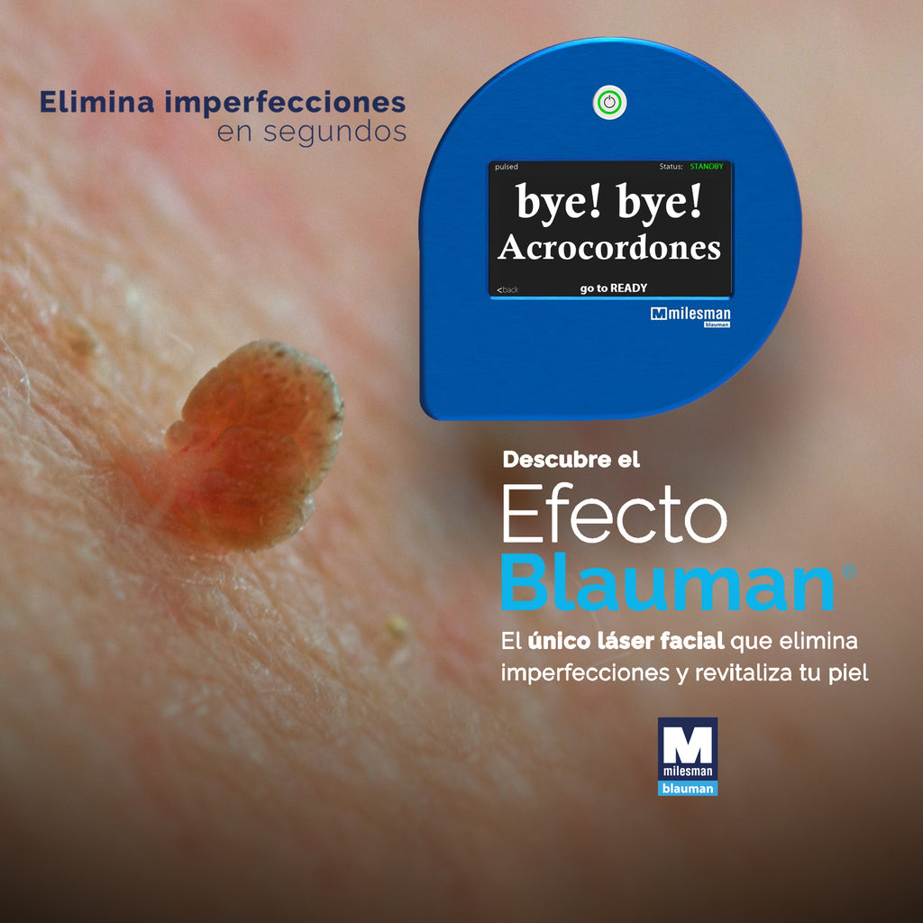 Laser Azul para lesiones benignas y manchas