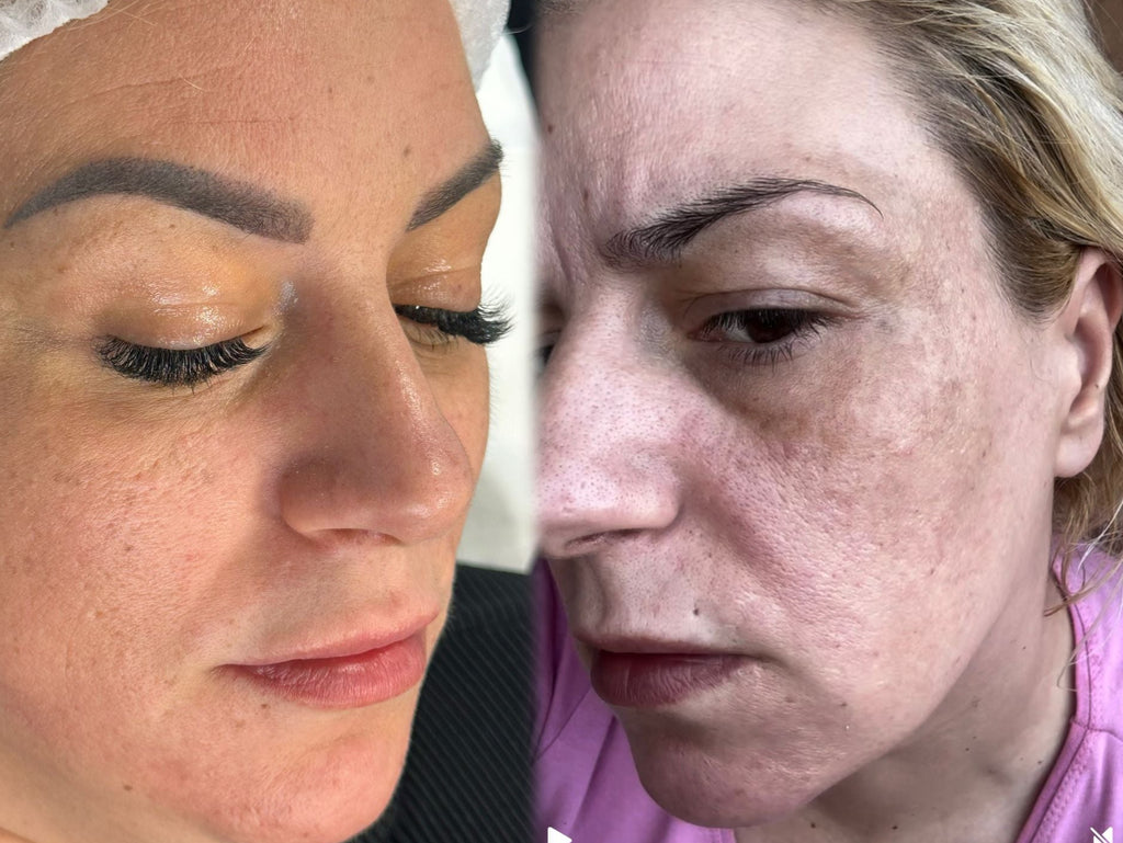 Perfect Tone Glow